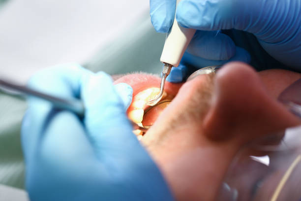 Best Knocked-Out Tooth Emergency  in Detroit Lakes, MN